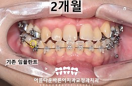 수술후