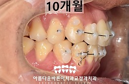 수술후
