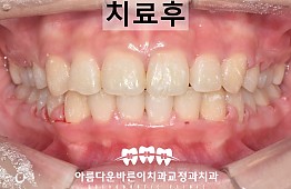 수술후