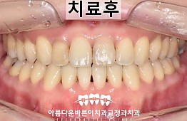 수술후