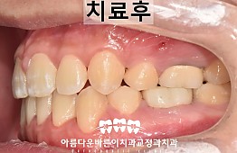 수술후