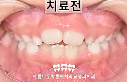 수술전