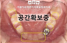 수술후