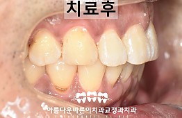 수술후