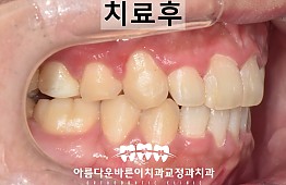수술후