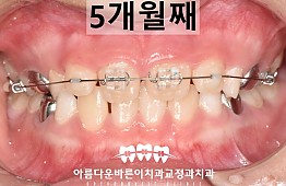 수술후