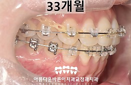 수술후