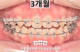 수술후