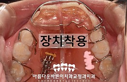 수술후