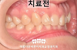 수술전