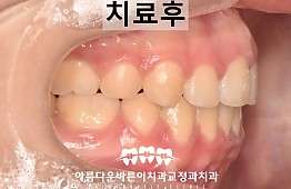 수술후