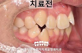 수술전