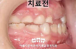 수술전