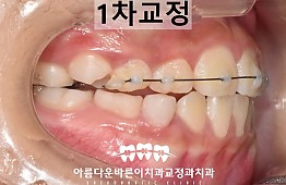 수술후