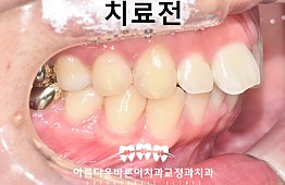 수술전