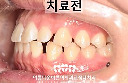 수술전