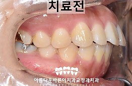 수술전