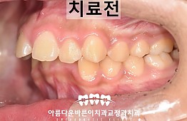 수술전