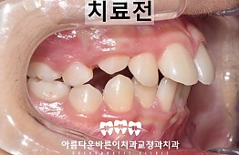 수술전