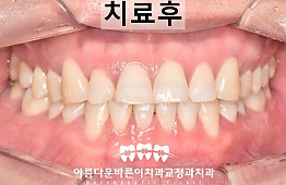 수술후