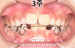 수술후