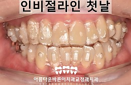 수술후