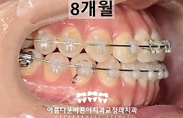 수술후