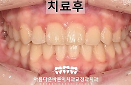 수술후