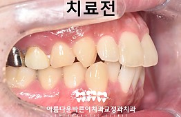 수술전