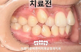 수술전