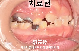 수술전