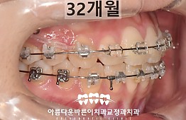 수술후