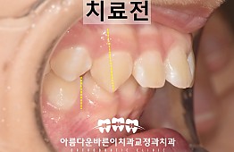 수술전