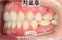 수술후