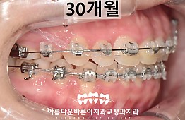 수술후