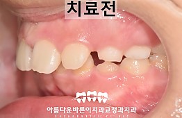 수술전