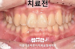 수술전