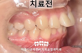 수술전