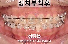 수술후