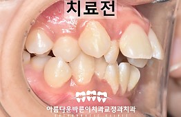 수술전