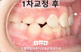 수술후