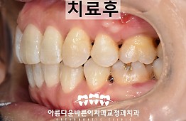 수술후