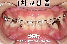 수술후