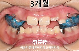 수술후
