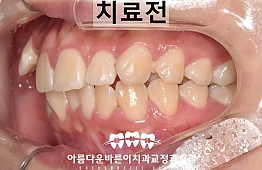 수술전