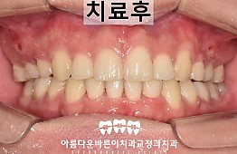 수술후