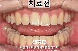 수술후