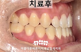 수술후