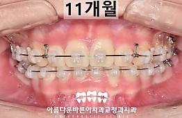수술후