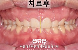 수술후